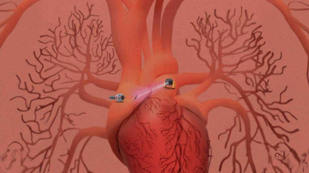 【倫理】人間の細胞（気管細胞）から作られた新型ロボット