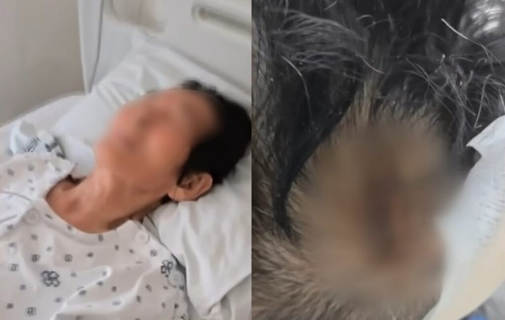 8歳児にぶつかられ高齢女性が重傷…韓国「治療費折半」提案に被害者側が激怒