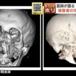 【クマ襲撃】被害者の9割が顔面損傷…鼻がなくなり骨は粉砕「体を大きく見せようと立ち上がって…」