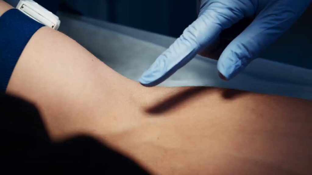 【世界初の自律型採血ロボットが登場】医療の人間的接触は失われるべきではないのかが議論に