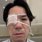 ジョーカー議員「失明するかも」眼帯姿を公開し一時活動休止を宣言　その後…経過を報告 (河合ゆうすけ氏)