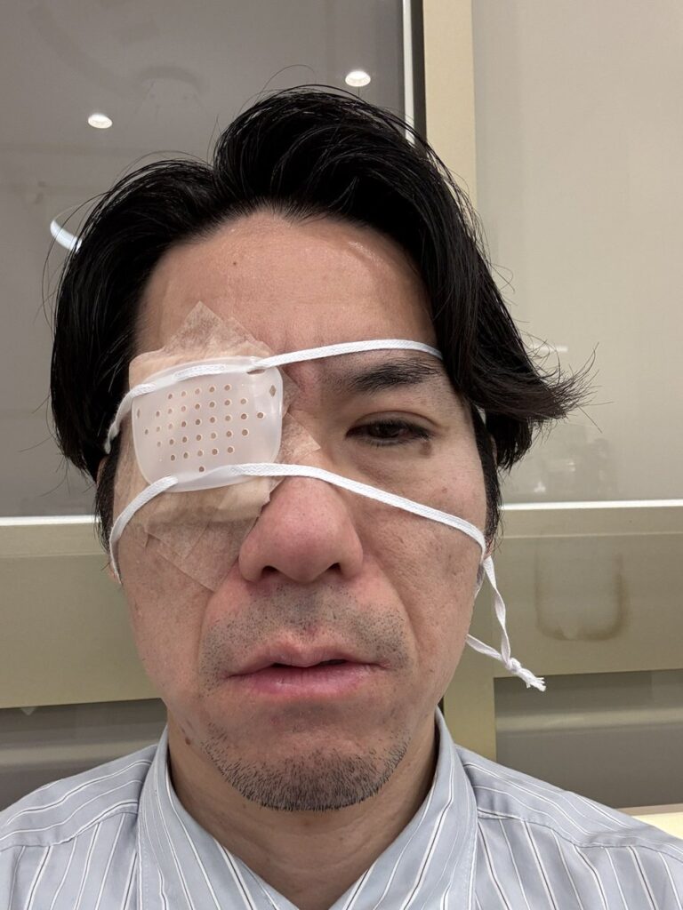 ジョーカー議員「失明するかも」眼帯姿を公開し一時活動休止を宣言　その後…経過を報告 (河合ゆうすけ氏)