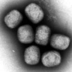 【厚労省】エムポックス重症型が日本国内で初確認　アフリカに渡航歴ある20代女性