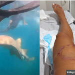 サメに襲われたシュノーケリング女性、噛まれる瞬間が撮影されていた