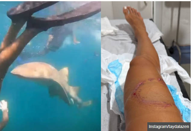 サメに襲われたシュノーケリング女性、噛まれる瞬間が撮影されていた