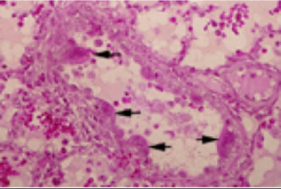 二パ様空港で止められる
