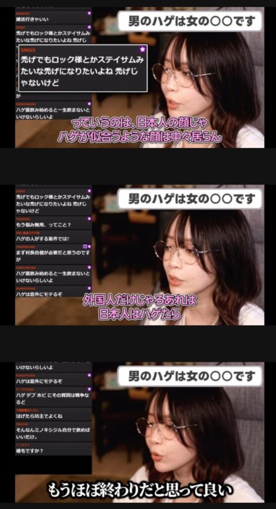 【悲報】たぬかな「ハゲたら人生終わり」