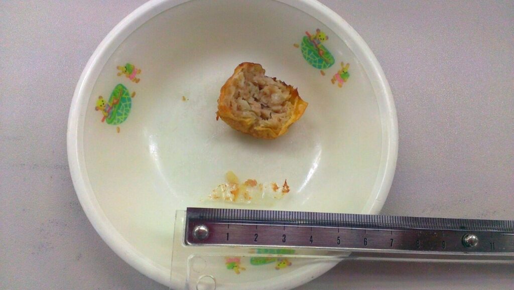 給食に異物混入、錠剤2つ　学校「マニュアルに従い明日からは慎重に調理します」