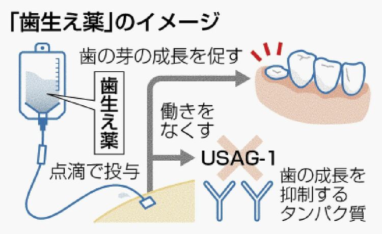 【続報／医療】日本発の「歯が生える薬」、ついに人間への治験が開始へ！！2030年の実用化を目指す