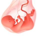 【医療】「男児 子を産む」山口県の21歳男性の体内から取り出されたフサフサの胎児