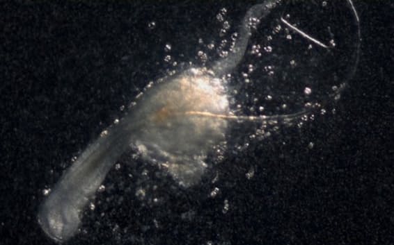 【研究】髪の毛作る「第3の細胞」発見　新たな脱毛症治療に、理研や国内新興