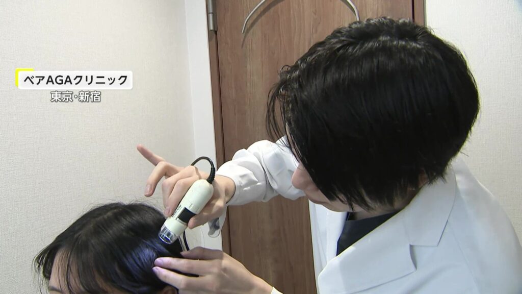 【テレビ】“30年に一度レベル”の少雨で「抜け毛」が増加…医師「乾燥で頭皮乱れ」　対処法は…　(AGAクリニック)