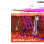 【朗報】薄毛を止める「光る帽子」を開発！毛包の老化を最大92%抑制