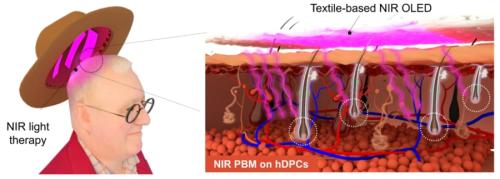 【朗報】薄毛を止める「光る帽子」を開発！毛包の老化を最大92%抑制