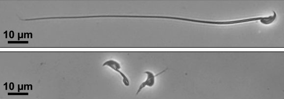 精子運動、特定タンパク質が必要　不妊治療に期待、大阪大
