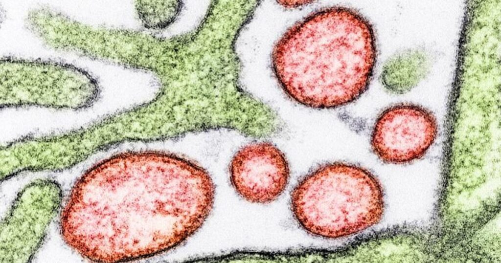 ニパウイルス、厚労省「国内の感染リスク低い」