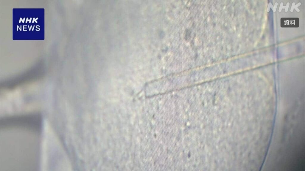 【社会】「出自を知る権利」で新見解の案 精子の提供者と会う権利尊重