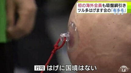 「ハゲに国境はない！」頭で吸盤綱引き　今年はイギリスから初の海外会員が…ツル多はげます会 新春の有多毛「つるつるつるの日」青森