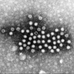 【オモニ】青森市の韓国家庭料理店で7人がノロウイルス食中毒　2月9～11日の営業停止命令