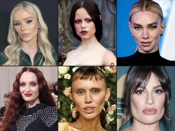 【悲報】アメリカのセレブの間で流行っている頬コケ整形に「これの何が良いの？」と疑問の声殺到。