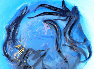 【安全性をヒトで実証】「お尻から呼吸する」東京科学大などのチーム　浣腸で酸素供給、呼吸不全の新治療法