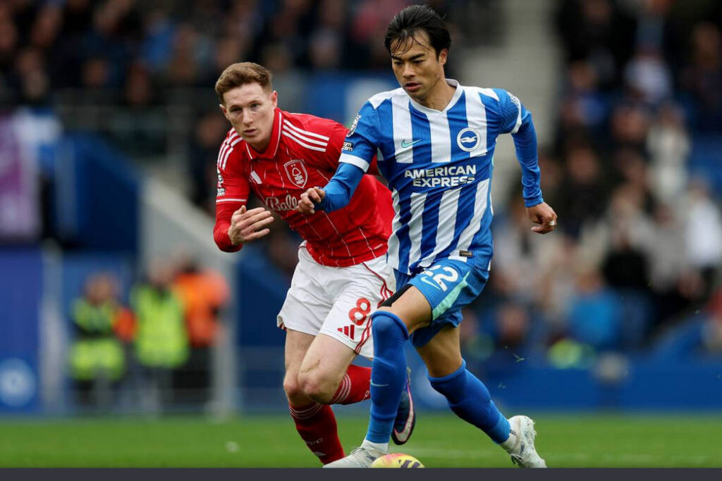 【画像】三笘、植毛疑惑浮上WWWW