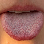 【スウェーデン農業科学大学、ウプサラ大学、コロラド大学の研究】新型コロナウイルス感染後の味覚喪失の原因を発見 「甘味、苦味、うま味といった感覚を司る味覚細胞の異常・機能不全が原因」