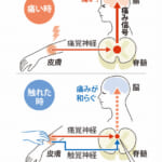 【研究】「痛いの痛いの飛んでいけー」に科学的根拠?　九大が神経特定