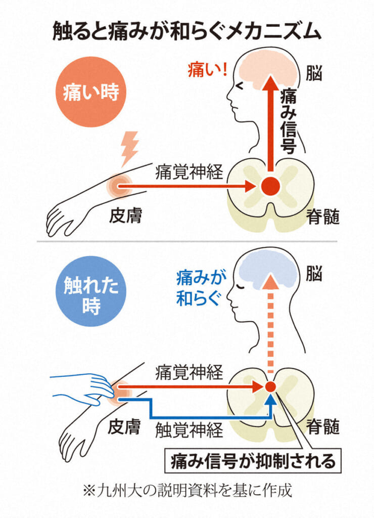 【研究】「痛いの痛いの飛んでいけー」に科学的根拠?　九大が神経特定
