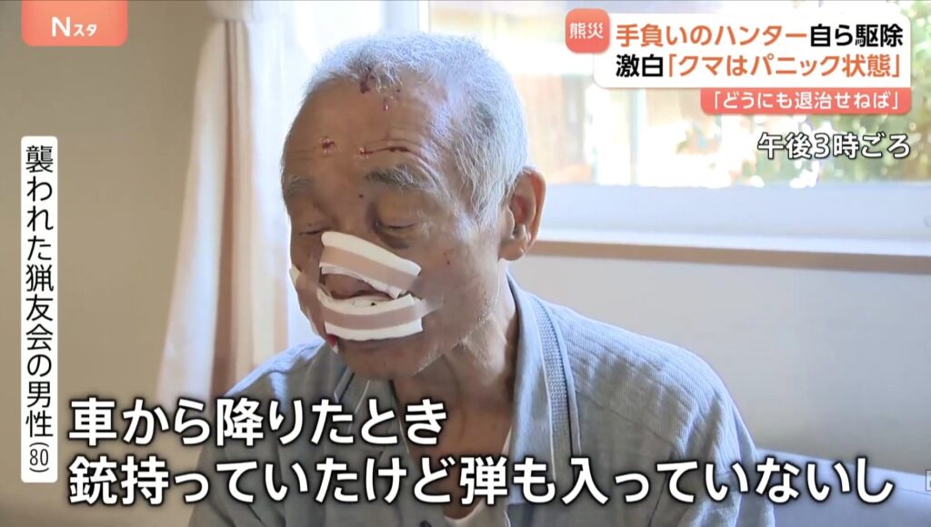 【悲報】猟友会のハンター(80)、クマの急襲に遭い顔面を咬まれるも反撃して射殺