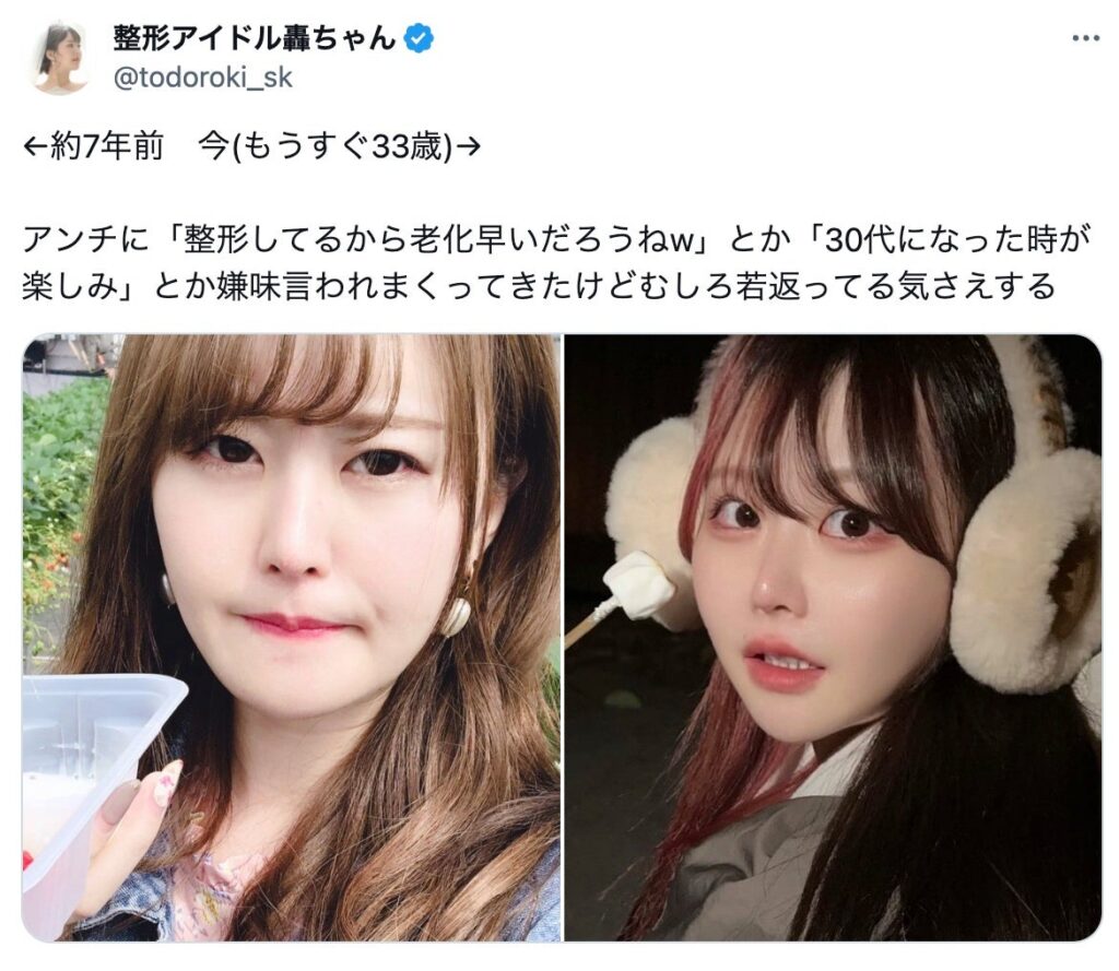 整形アイドル轟ちゃん（32）「整形してるから老化早い」の声に7年前とのビフォアフ公開「若返ってる」「どんどん綺麗になる」と反響