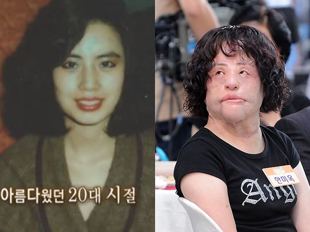 【特集】整形手術の副作用で苦しんだ「扇風機おばさん」、7周忌　死因は未だに不明のまま