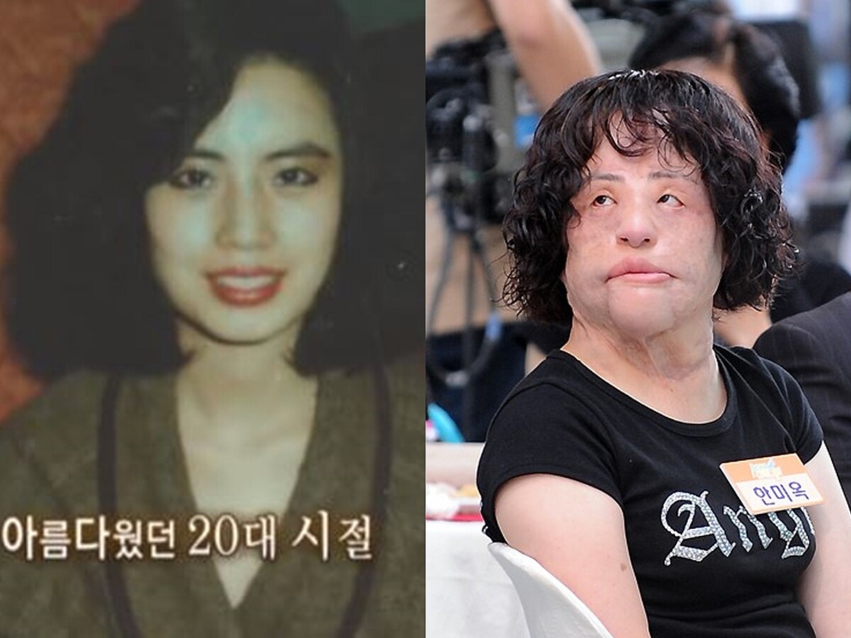 【特集】整形手術の副作用で苦しんだ「扇風機おばさん」、7周忌　死因は未だに不明のまま