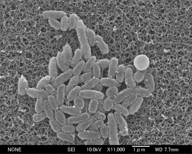 百日ぜき、薬剤耐性菌が8割　治療に弊害、感染症研究所調査