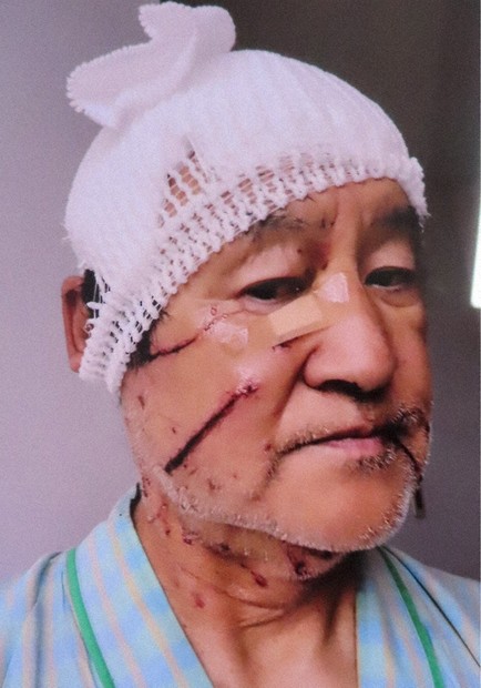 【クマ】「無差別テロ」に鈴やスプレーが効くのか　クマの恐怖、防具開発を