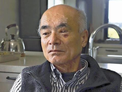 【（・(ｪ)・）】クマに顔引き裂かれ、神経・筋肉失い手術５回…後遺症に苦しむ男性「駆除しないと」「かわいそうとは思わないよ」