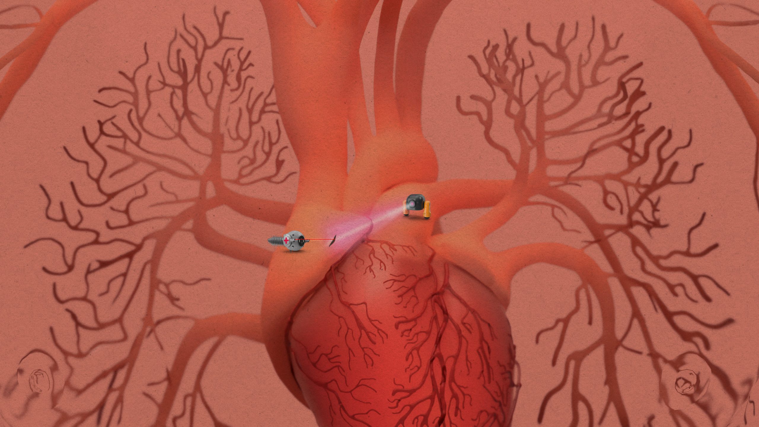 【倫理】人間の細胞（気管細胞）から作られた新型ロボット