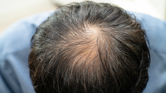 人間の髪の毛は押し出されるのではなく「引っ張られる」ことで成長する