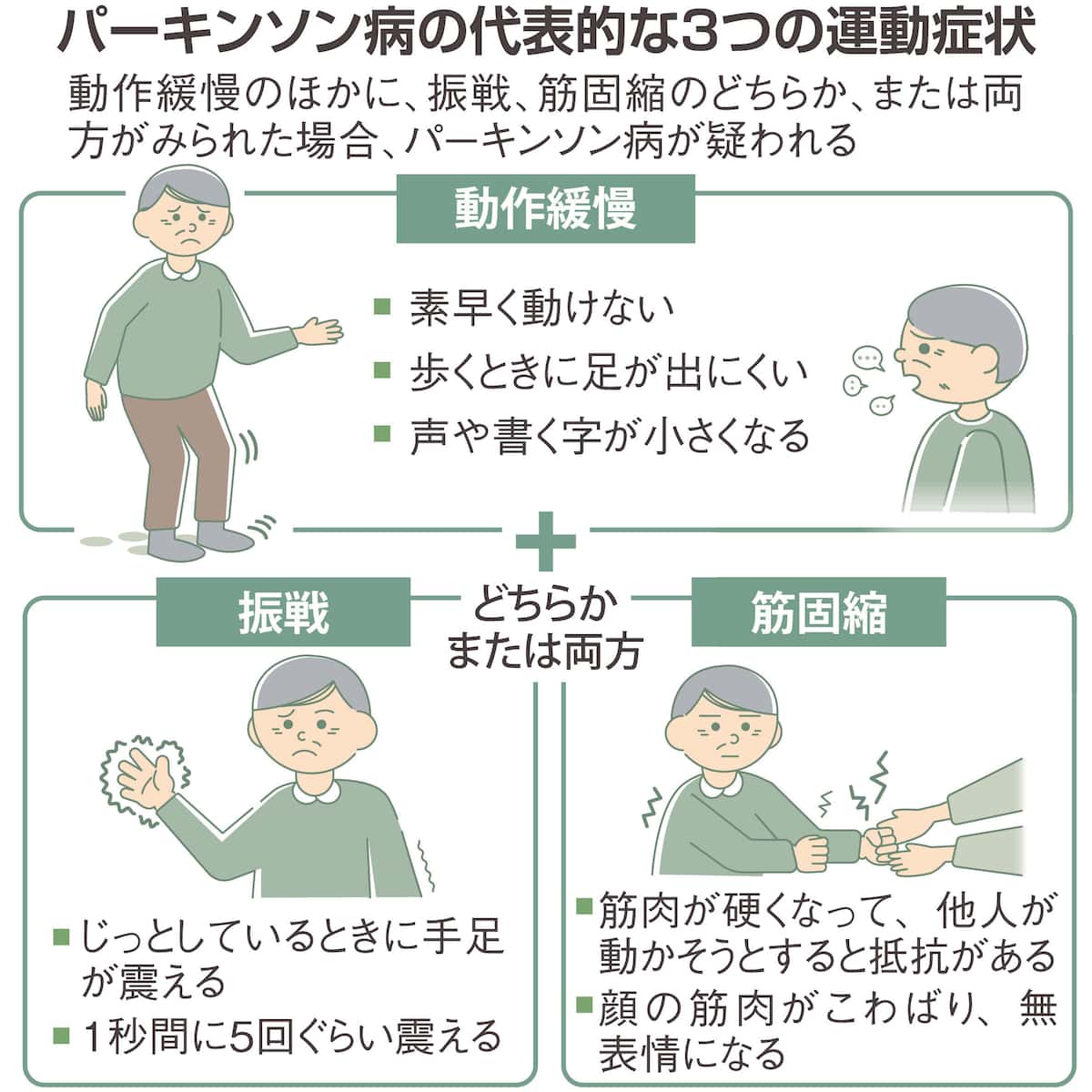 【健康】手足が震え、足が出にくい…増えるパーキンソン病、治療法の進歩で支障のない暮らしも