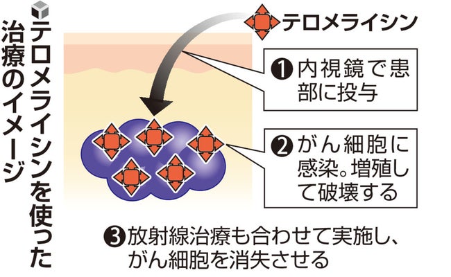 【医療】がん細胞だけ壊す特殊なウイルスで食道がん治療、初の薬を岡山大発新興企業が申請…抗がん剤治療を代替する可能性も
