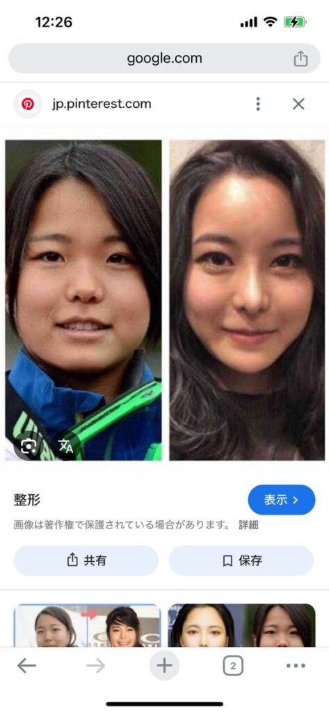 【画像あり】　スキーの高梨沙羅選手　顔が変わりすぎて誰だか分からなくなる・・