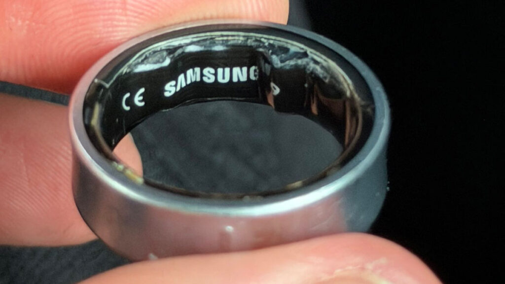 【サムスン】スマートリング「Galaxy Ring」が膨張し装着者は病院に