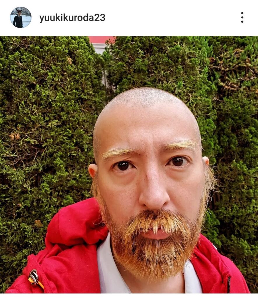 【画像】黒田勇樹さん、現在の姿がとんでもないことになっていたWW