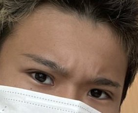 【悲報】ゆたぼん、事故の治療費をネットで乞食して整形代に使ってる疑惑浮上w