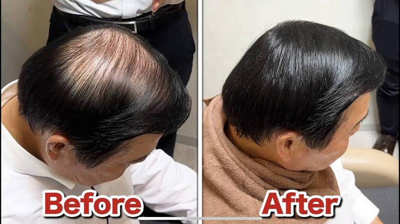 【5ch民】パチスロ「ミリオンヘアー・ハゲデス」にありがちなこと