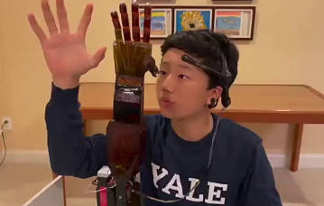 【17歳の高校生が“脳で動く義手”をたった300ドルで作り、業界に衝撃が走っている】本物は45万ドル──その差、1500倍