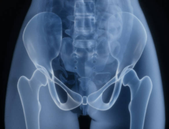 【2025年版】肛門から出てきた物ランキング　1位野球ボール　2位バッテリー式ライト　3位髭トリマー