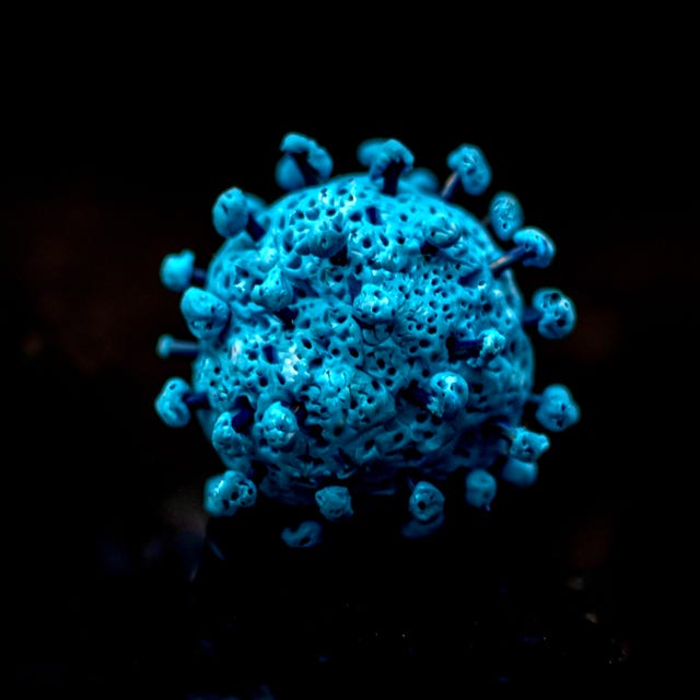 【新型コロナの新変異株】XFG（ストラタス）の初期症状に医師が警鐘「特にワクチンやブースター接種を最近受けていない人は注意が必要。インフルエンザに比べ後遺症（ロング・コビッド）のリスクも無視できません」